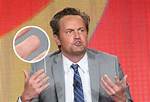 Matthew Perry's Finger: Surprising Facts You Must Know!