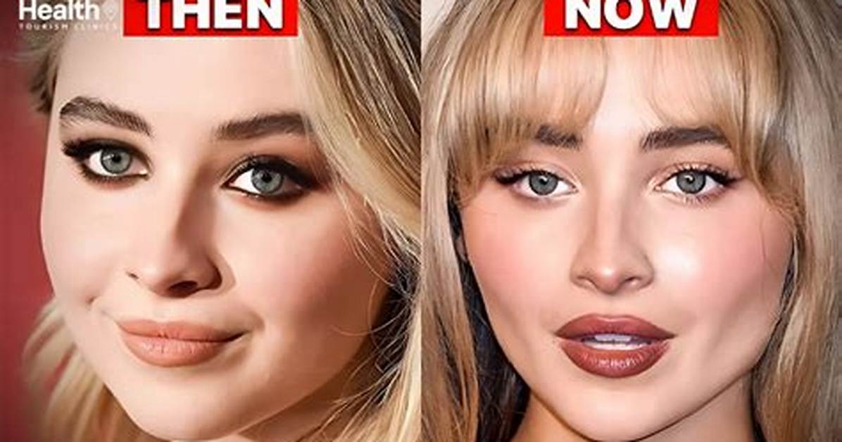 Sabrina's Plastic Surgery Transformation: Before and After Photos.