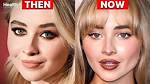 Sabrina's Plastic Surgery Transformation: Before and After Photos.