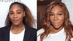 Serena Williams' Plastic Surgery Journey: a Comprehensive Overview