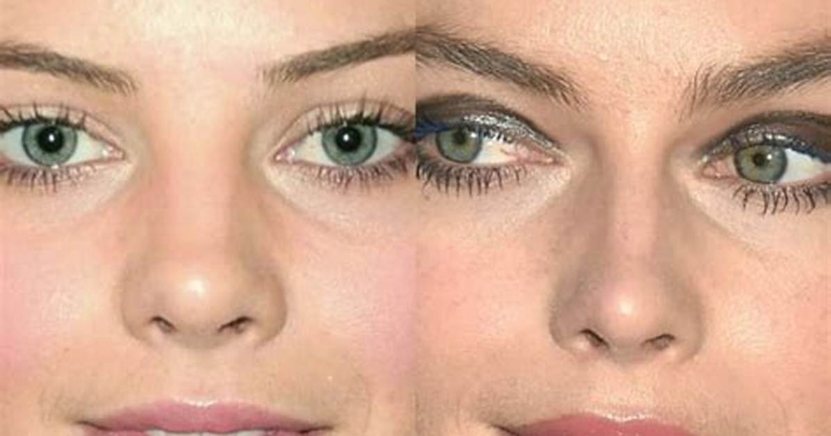 Unveiling the Truth: Margot Robbie's Nose Job Rumors